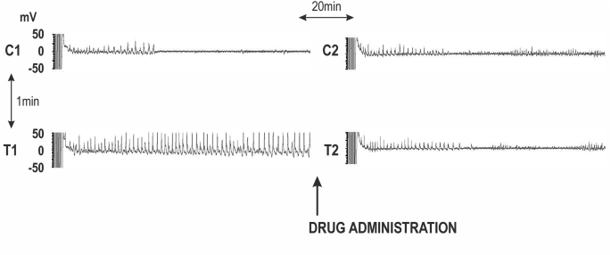 Three neurosteroids as well as GABAergic drugs do not convert immediate postictal potentiation to depression in immature rats